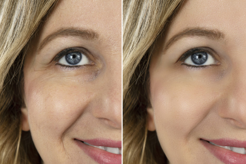 Retouche de texture de peau sur le visage